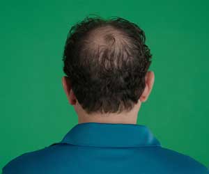 Hair Grow Max 2x1 a 214 PLN