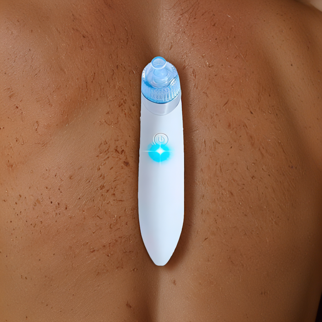 RAIREX PORE BLACKHEAD REMOVER